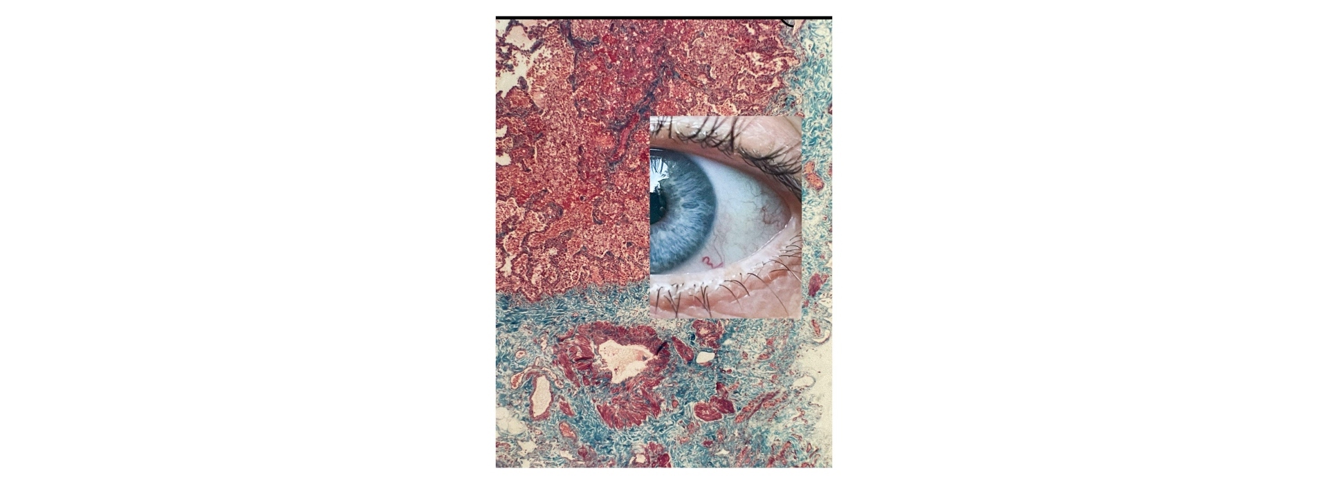 Membrana