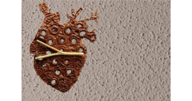 A,L.O – Arte, Literalmente, plástic.O