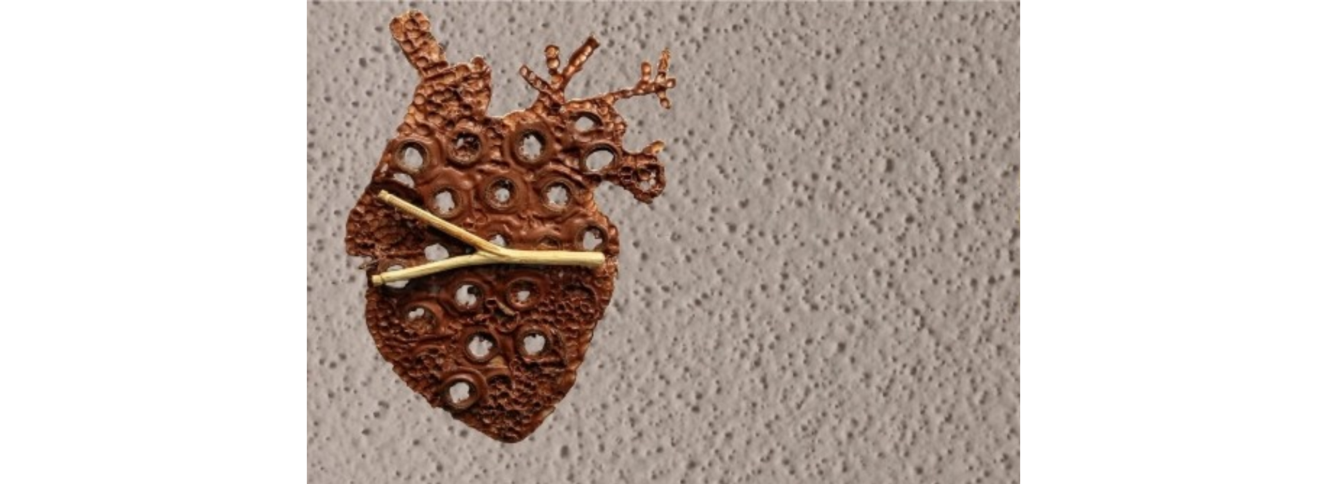 A,L.O – Arte, Literalmente, plástic.O